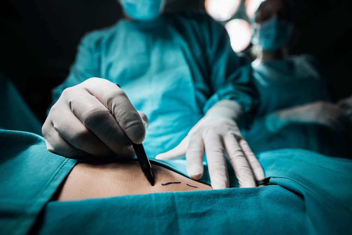 Cirurgia Plástica