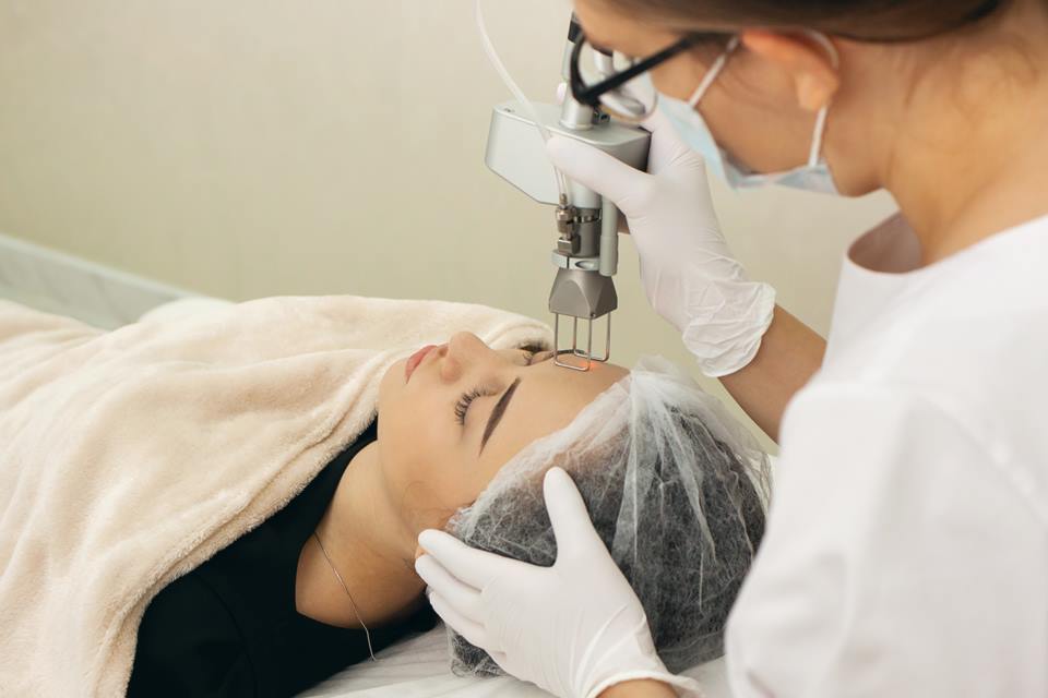 Peeling de fenol