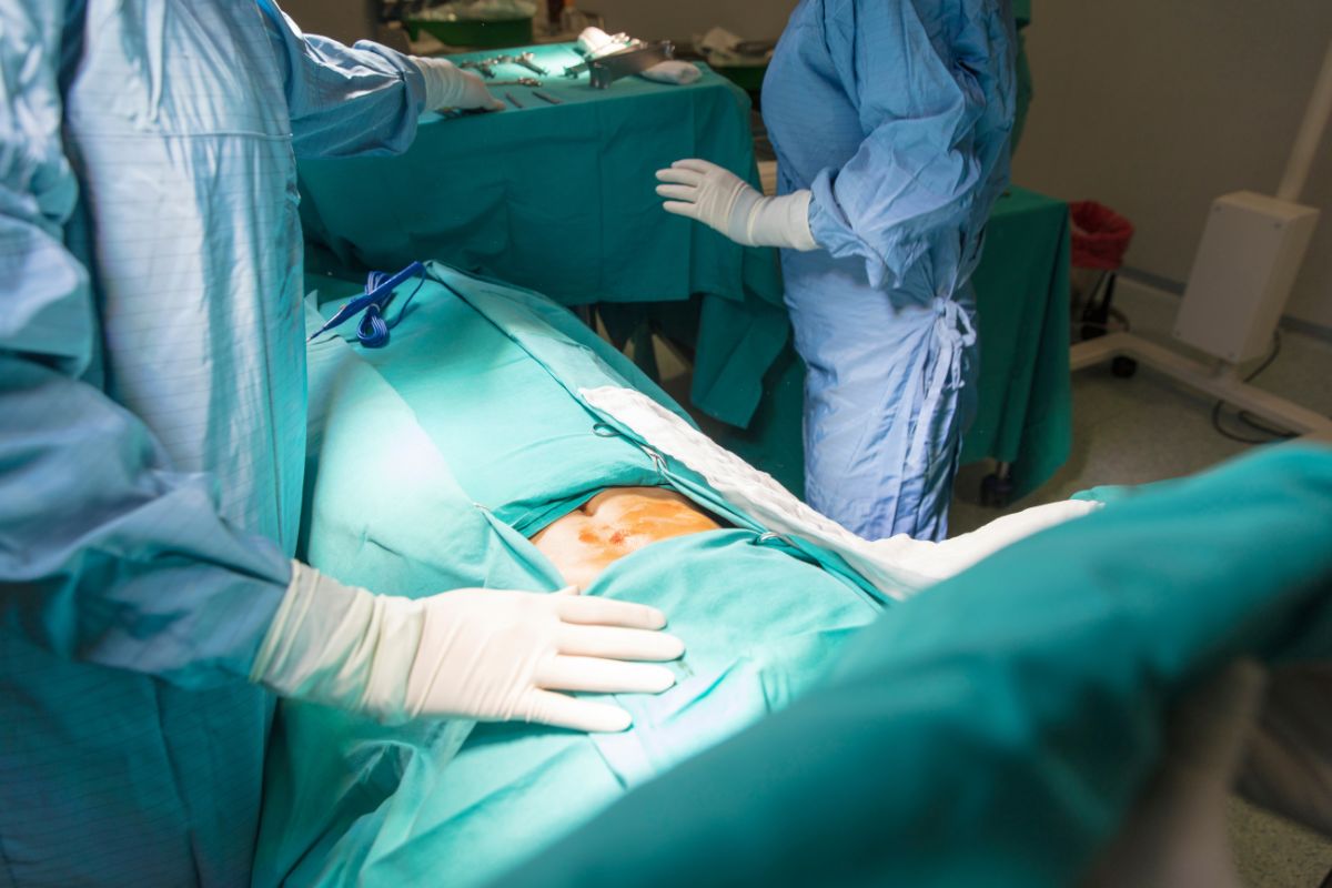 foto colorida de procedimento de cirurgia no abdômen
