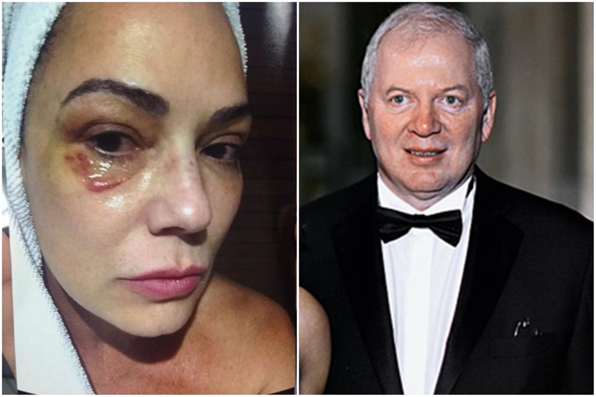 Ex de Luiza Brunet é condenado a pagar R$ 150 mil por agredir a modelo