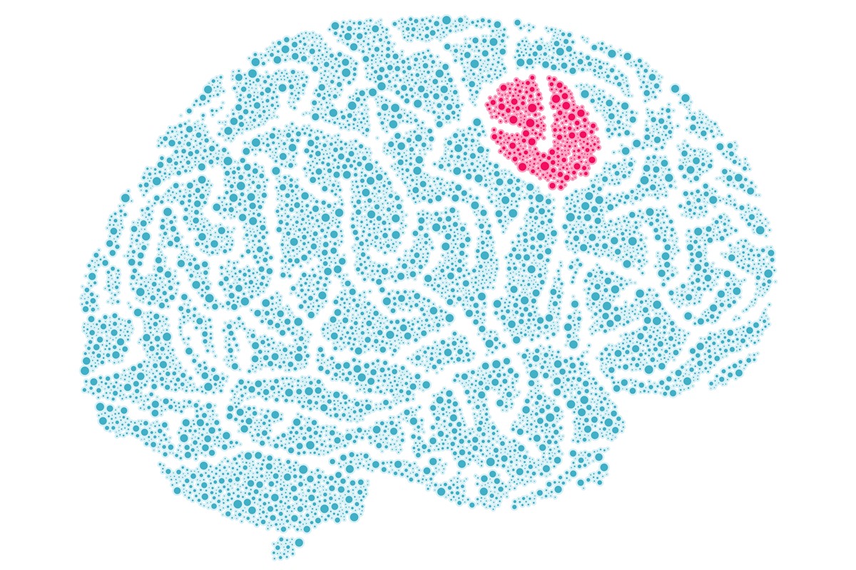 Novo teste promete fazer diagnóstico de tumor cerebral cair para duas horas