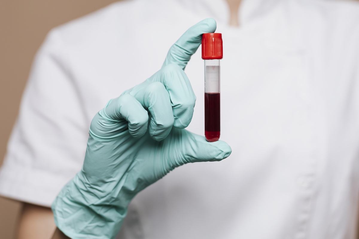 Estudo investiga se há risco de transmissão do Alzheimer pelo sangue