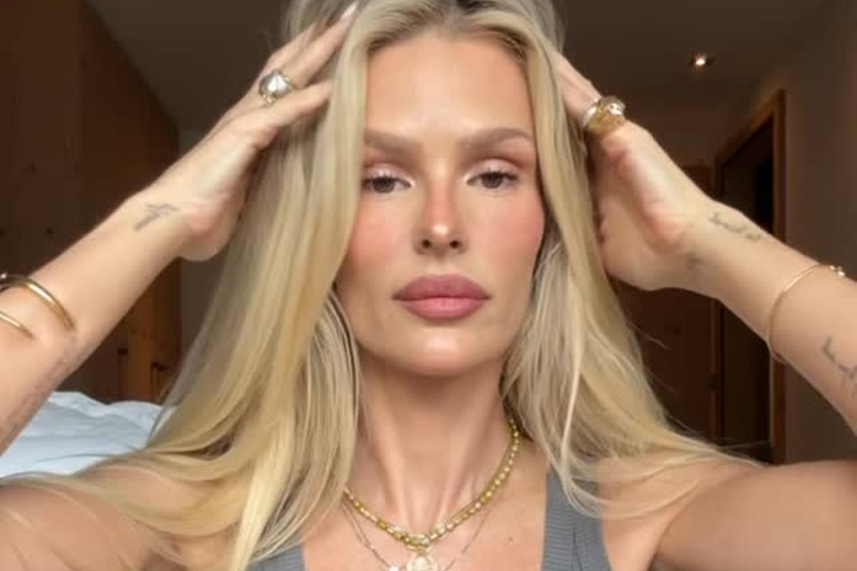 Yasmin Brunet exibe marcas do lipedema e relata dor e queimação - QTU Questões do Universo