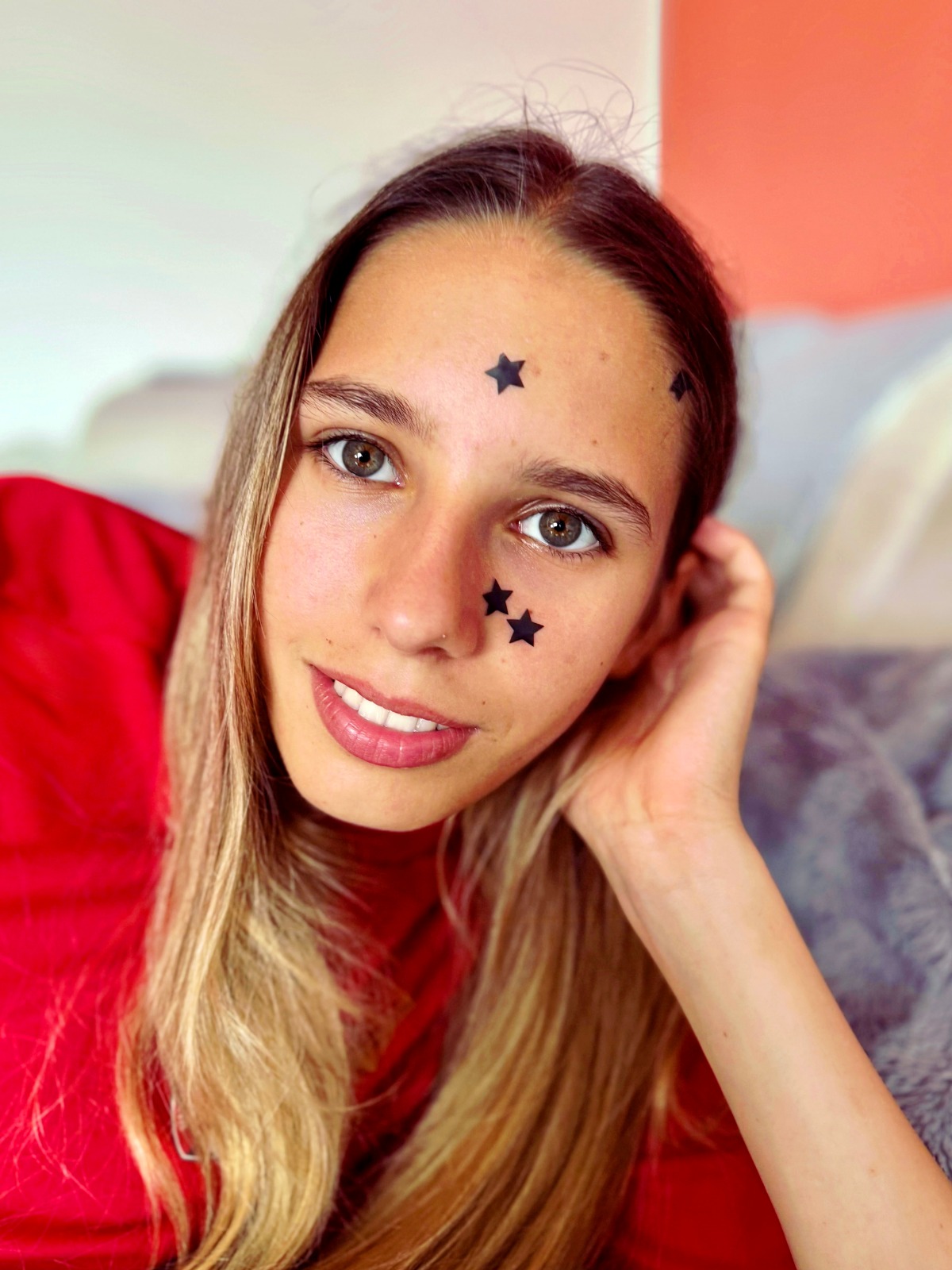 Foto colorida de menina com adesivos para espinhas