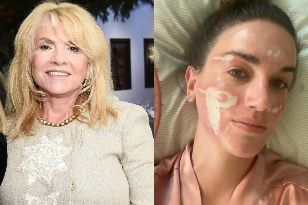Esteticista de famosas perde licença após causar lesões em cliente