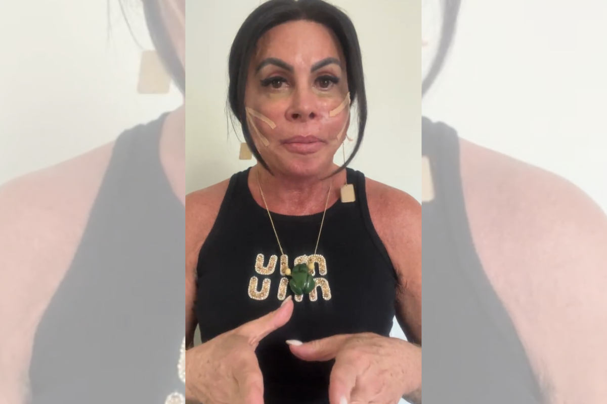 Gretchen com os fios de sustentação no rosto