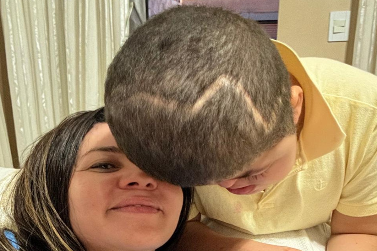 Mãe e filho com Síndrome de Apert- Metrópoles