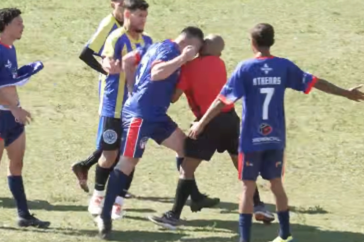 Árbitro de futebol leva cabeçada e precisará passar por cirurgia