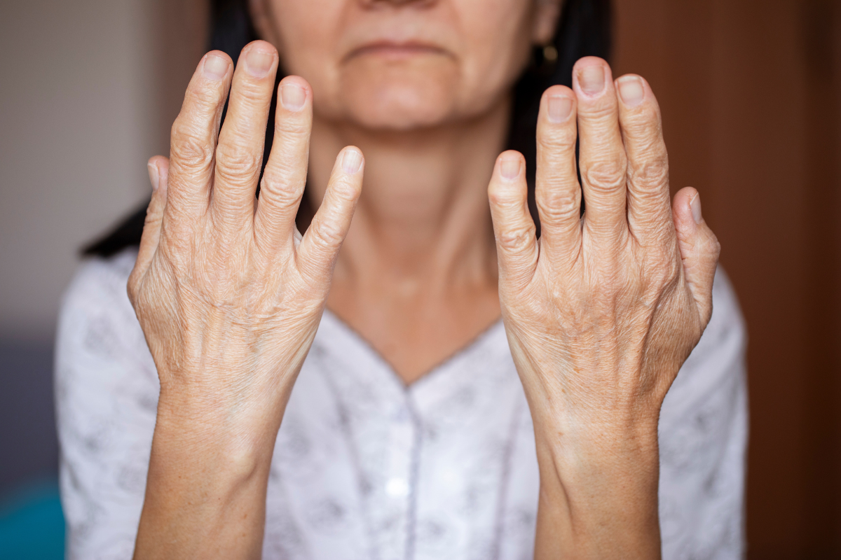 O preenchimento de mãos é a mais recente tendência antienvelhecimento que está conquistando os Estados Unidos