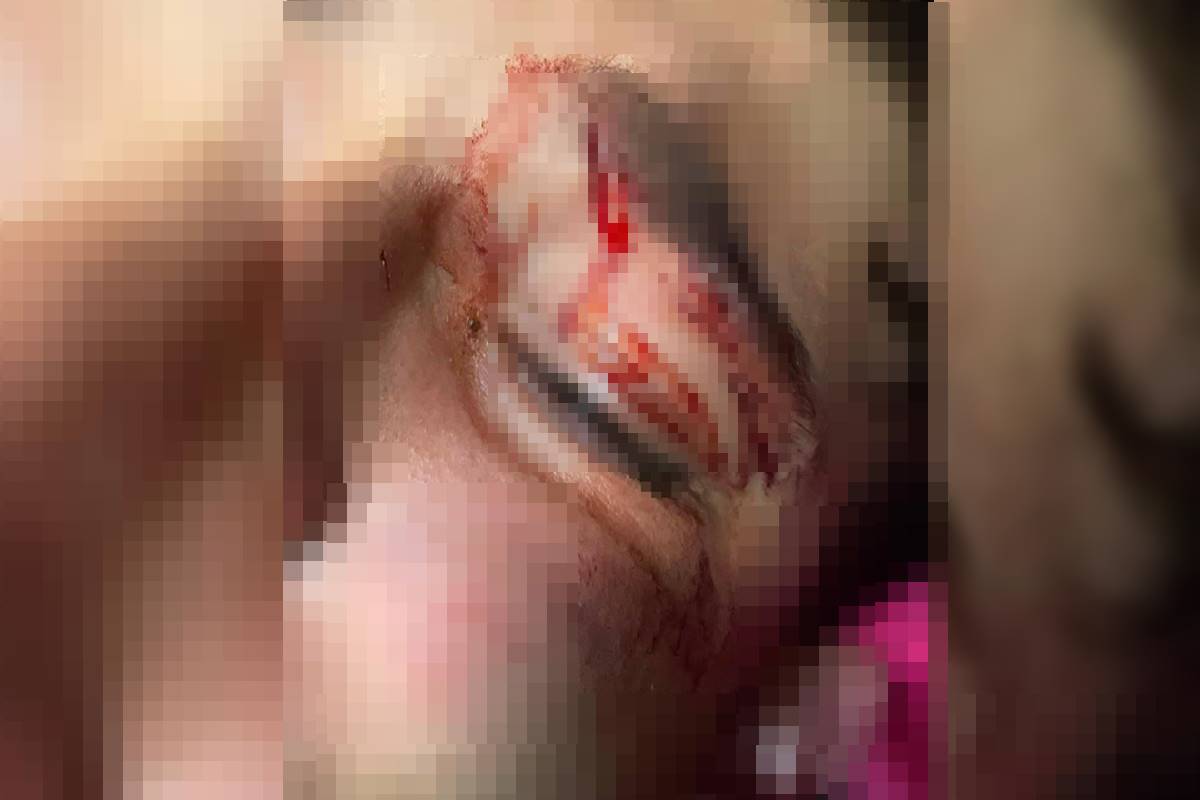 Adolescente espancado por PM em GO dizia que ia morrer, relata mãe