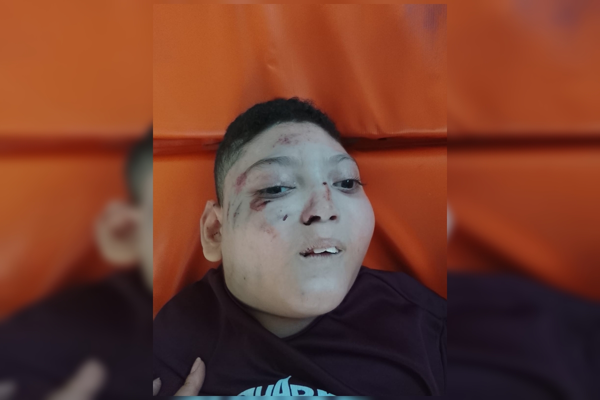 Imagem vinculada ao feed original: Menino cadeirante cai de escada rolante no Metrô-DF e vai parar na UTI