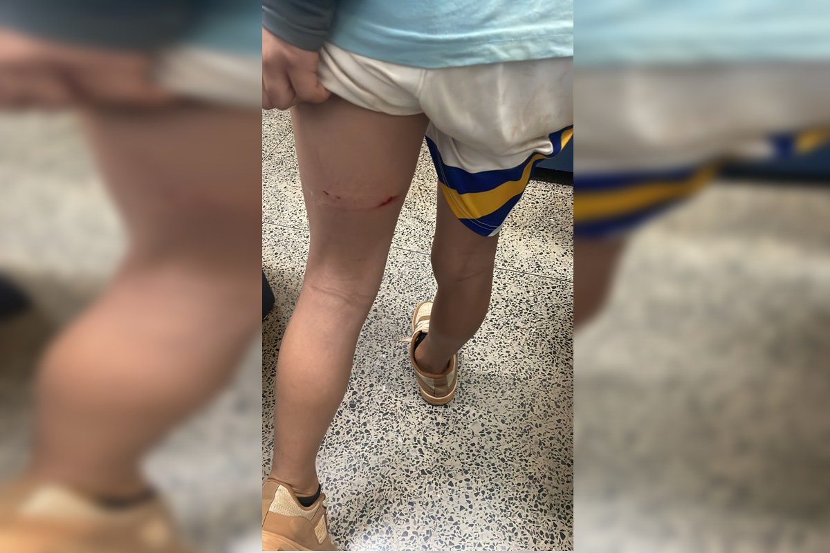 Mãe acusa professora de agredir aluno de 11 anos em escola no DF