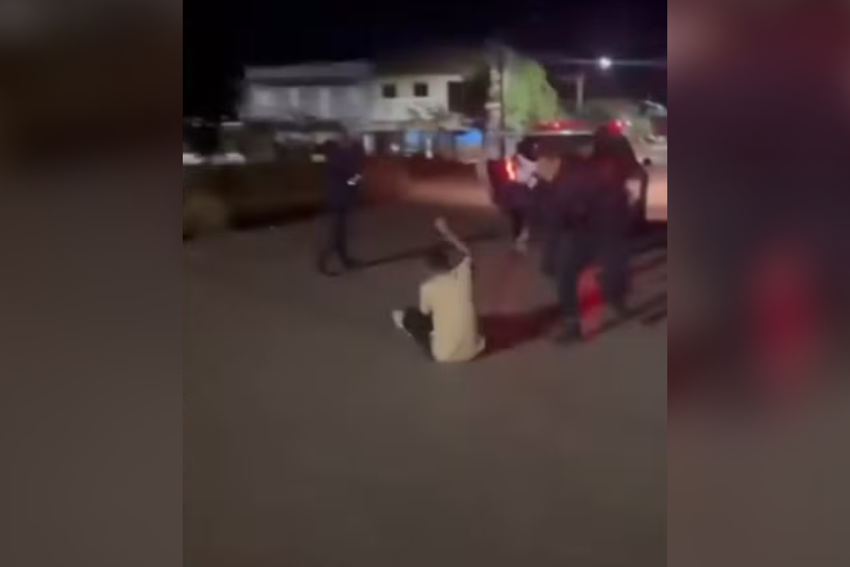 Jovem sofre traumatismo craniano após ser agredido por guarda municipal