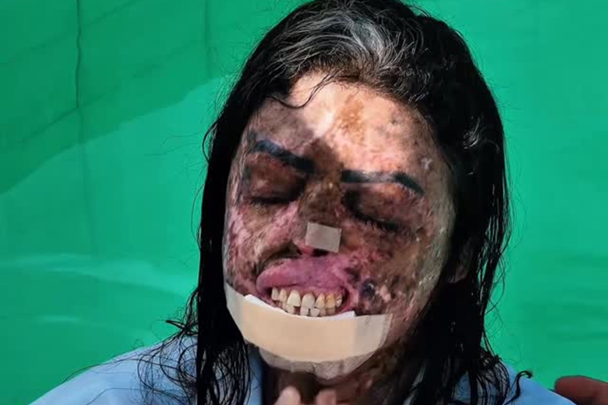 Quem foi Karine Felipe, influencer que lutou contra câncer terminal