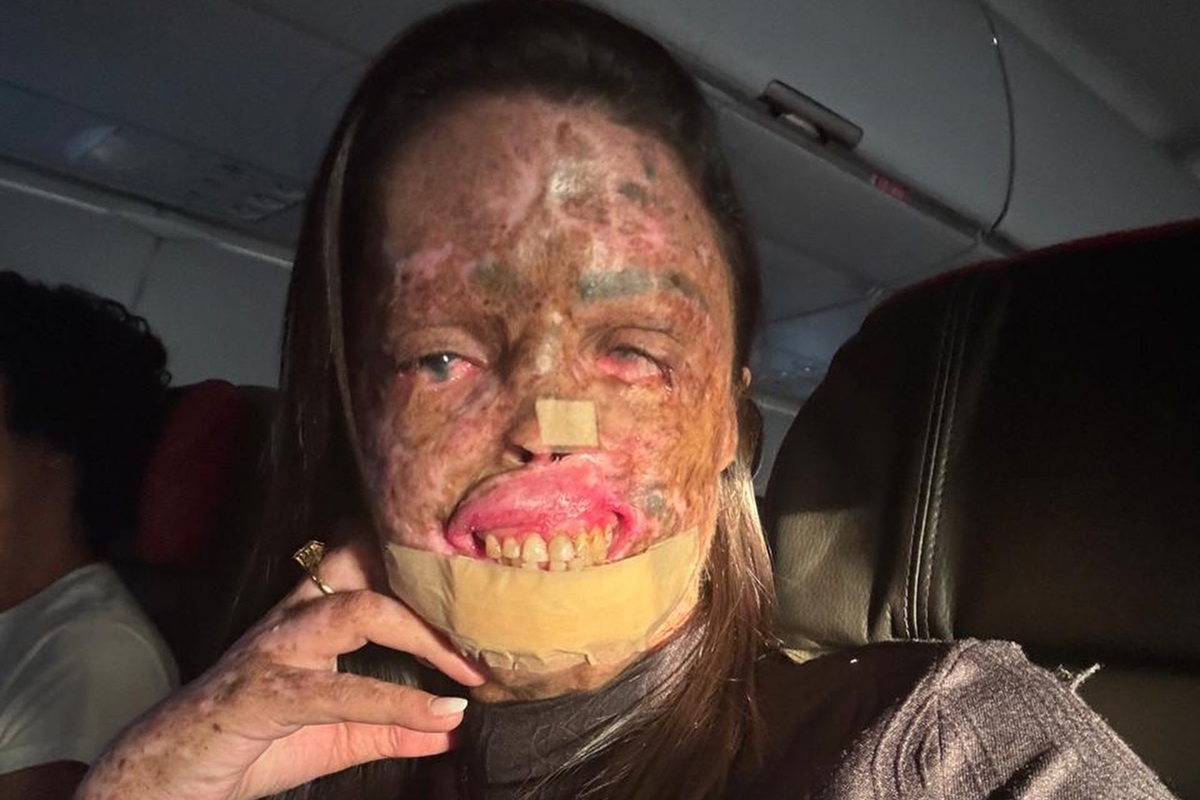 Morre Karine Felipe, influencer que lutava contra doença rara