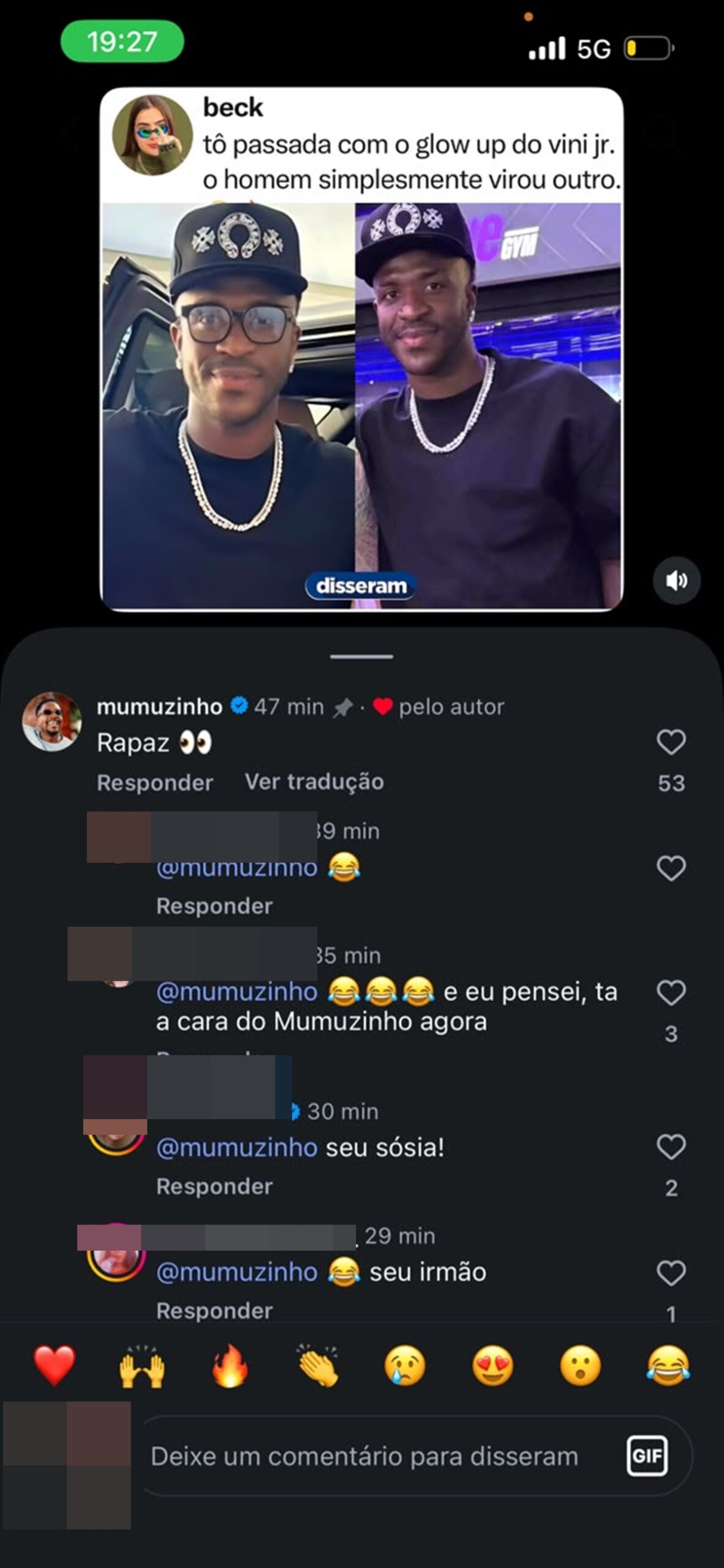 Mumuzinho reage a comparações com Vini Jr. após procedimento