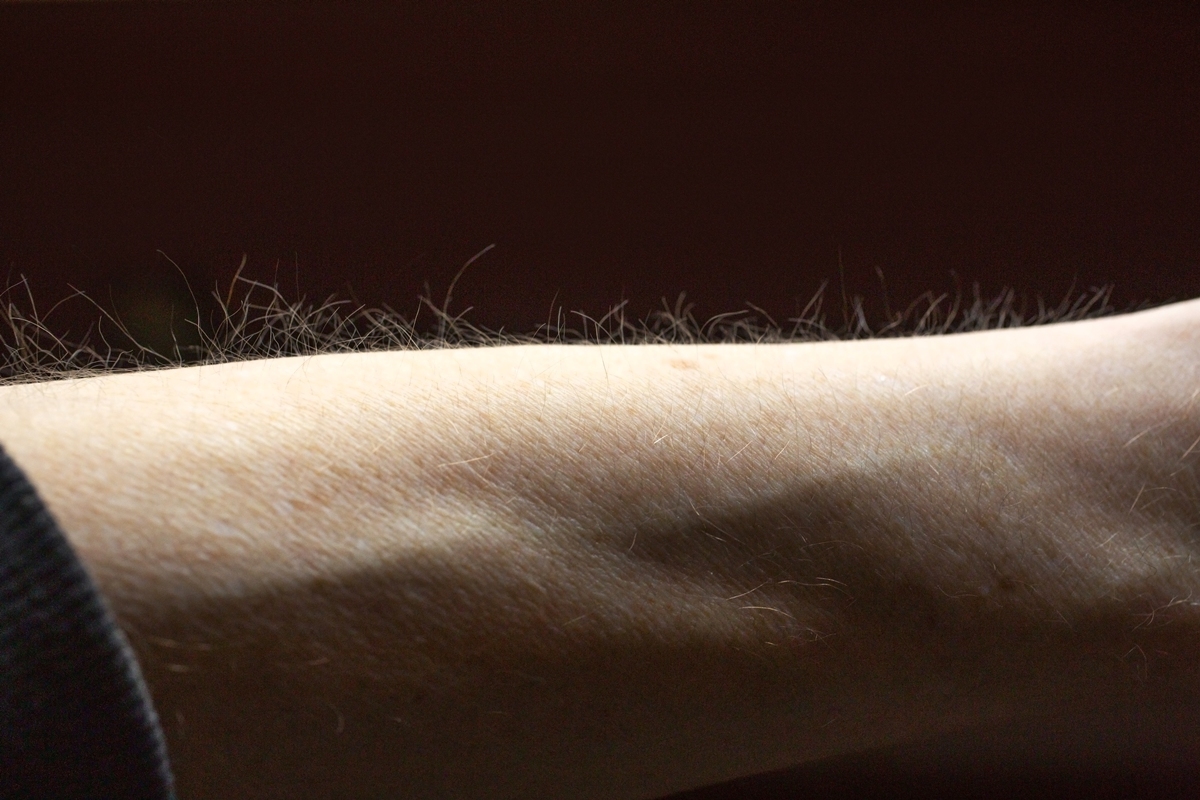 Pelos da pele podem ajudar o corpo a detectar coceira, sugere estudo