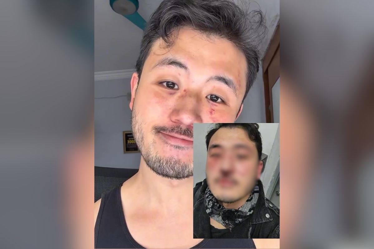 Professor relata agressão no metrô de SP e diz ter sofrido homofobia