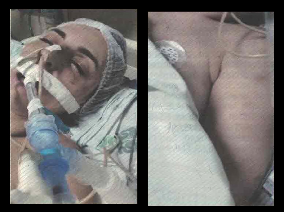 No hospital, Selma Vieira, vítima do marido Eden Márcio e da amante Carolina Lacerda, estava com hematomas