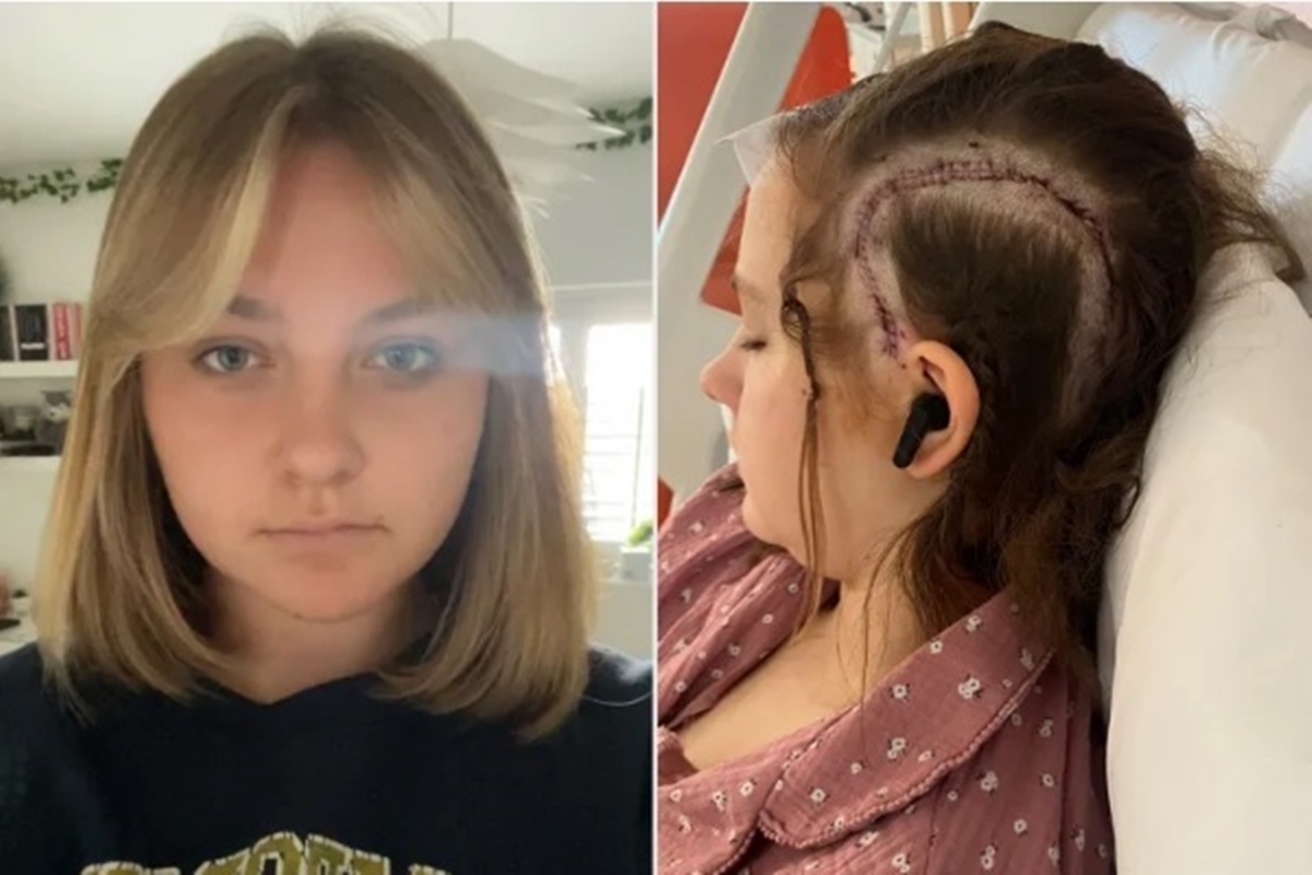 Inglesa se torna paciente mais jovem a passar por cirurgia acordada