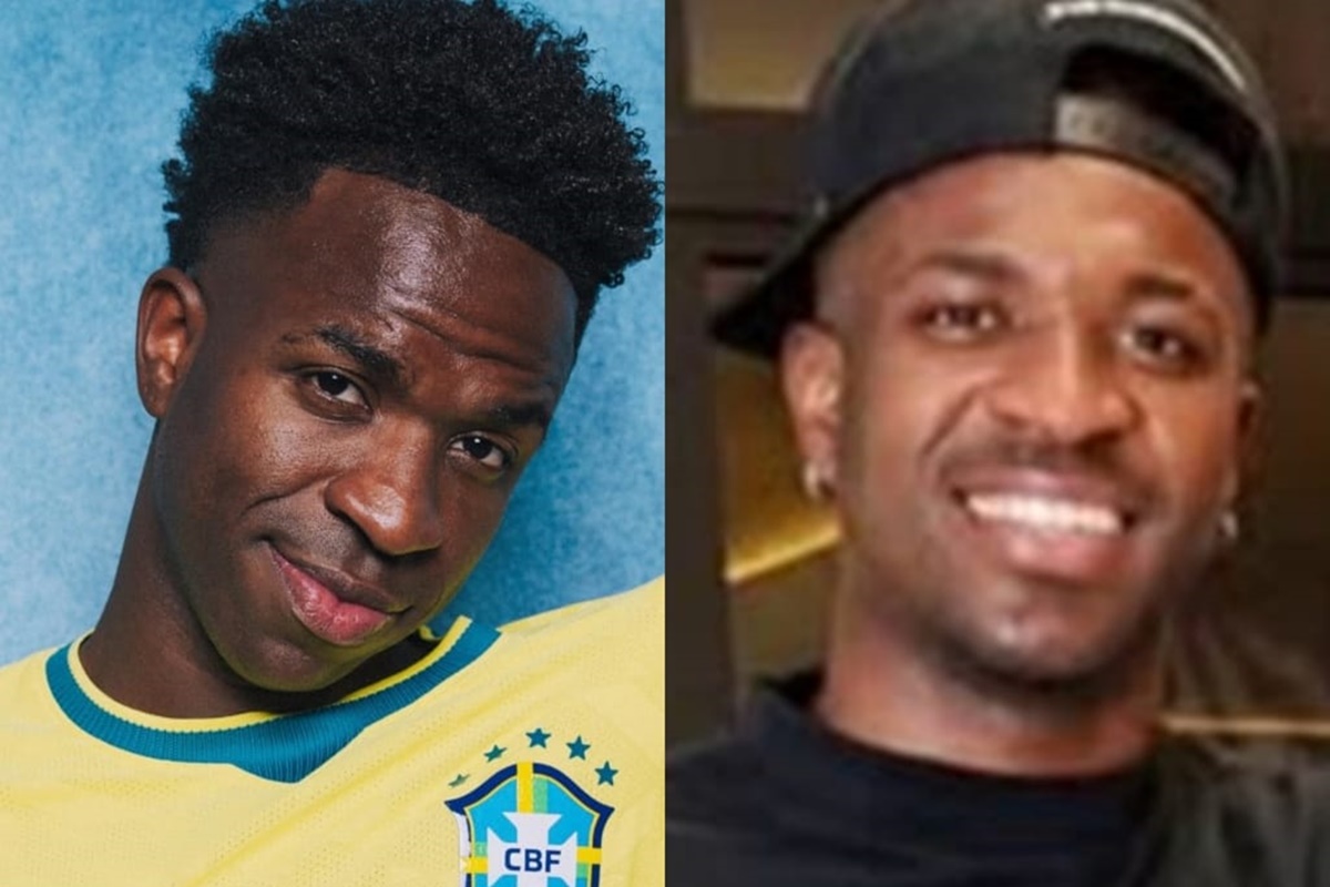 Vini Jr.: harmonização melhora rosto, mas não a respiração pela boca