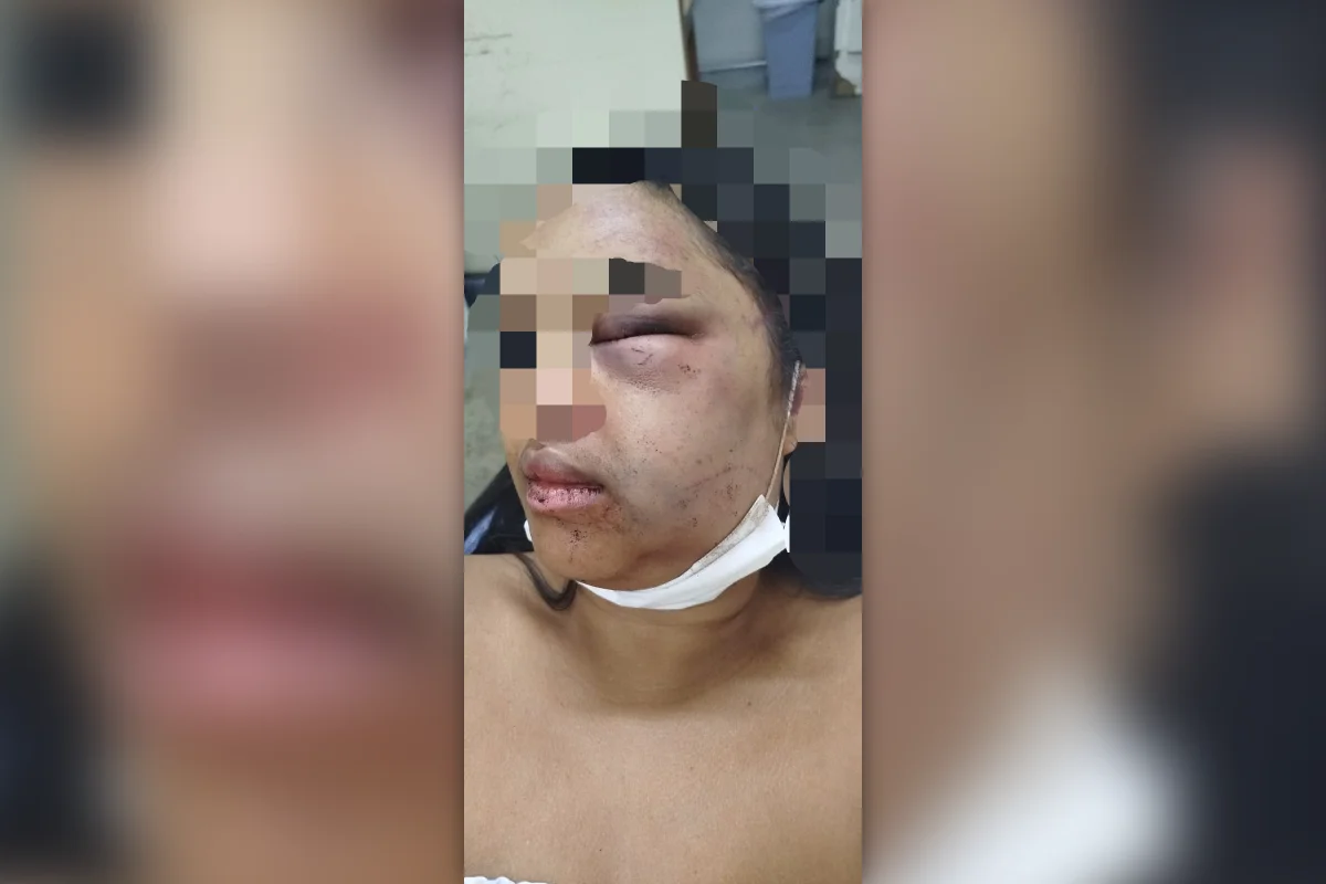 Caso de Violência Doméstica Choca Planaltina: Mulher Agredida Pelo Ex-Companheiro