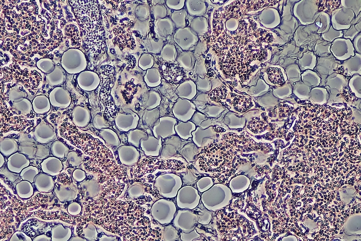 Estudo testa composto que faz corpo queimar gordura sem reduzir apetite - QTU Questões do Universo