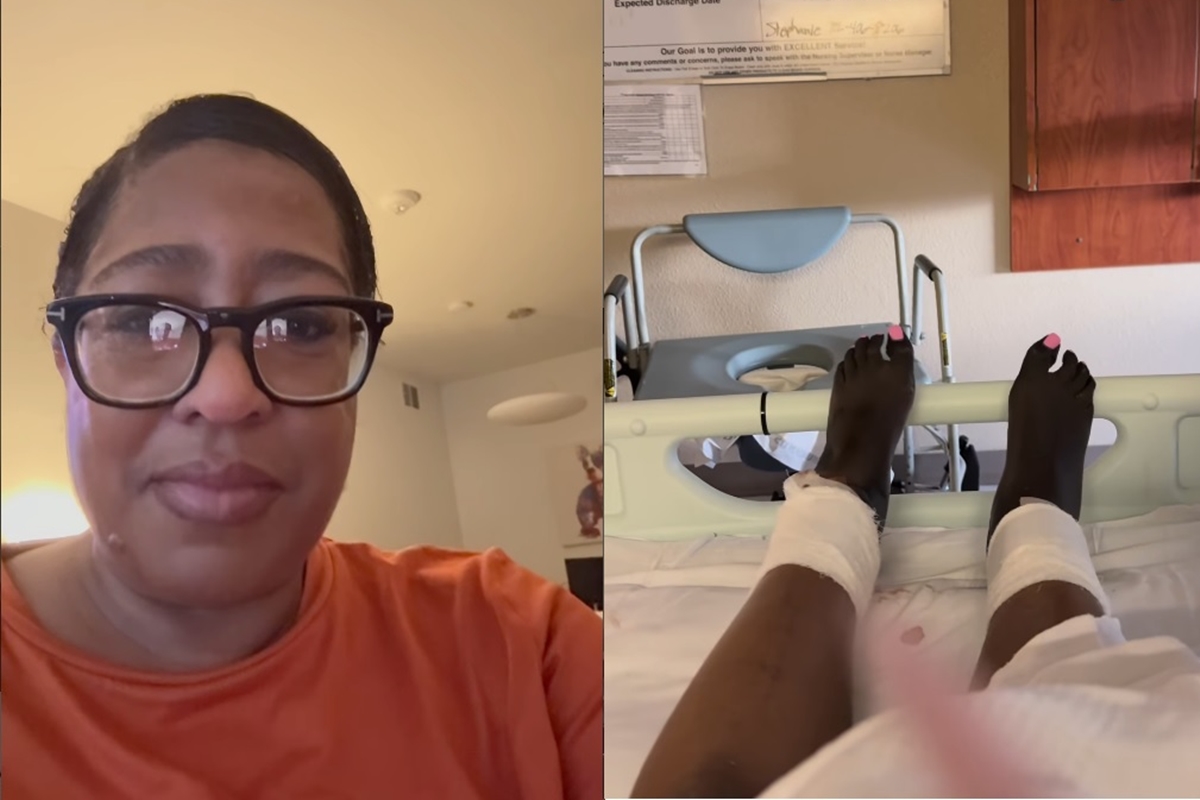 Após gripe, mulher tem choque séptico e precisa amputar as pernas