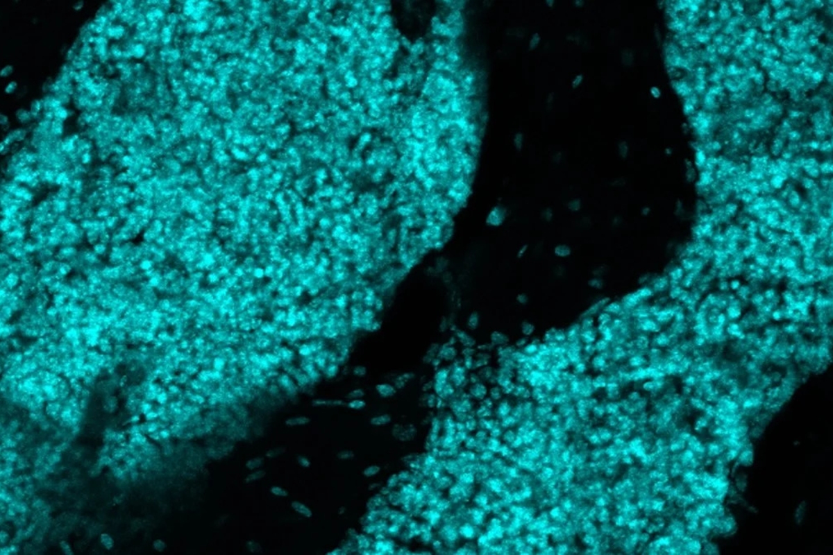 Cientistas descobrem órgão no crânio que pode atuar contra tumores