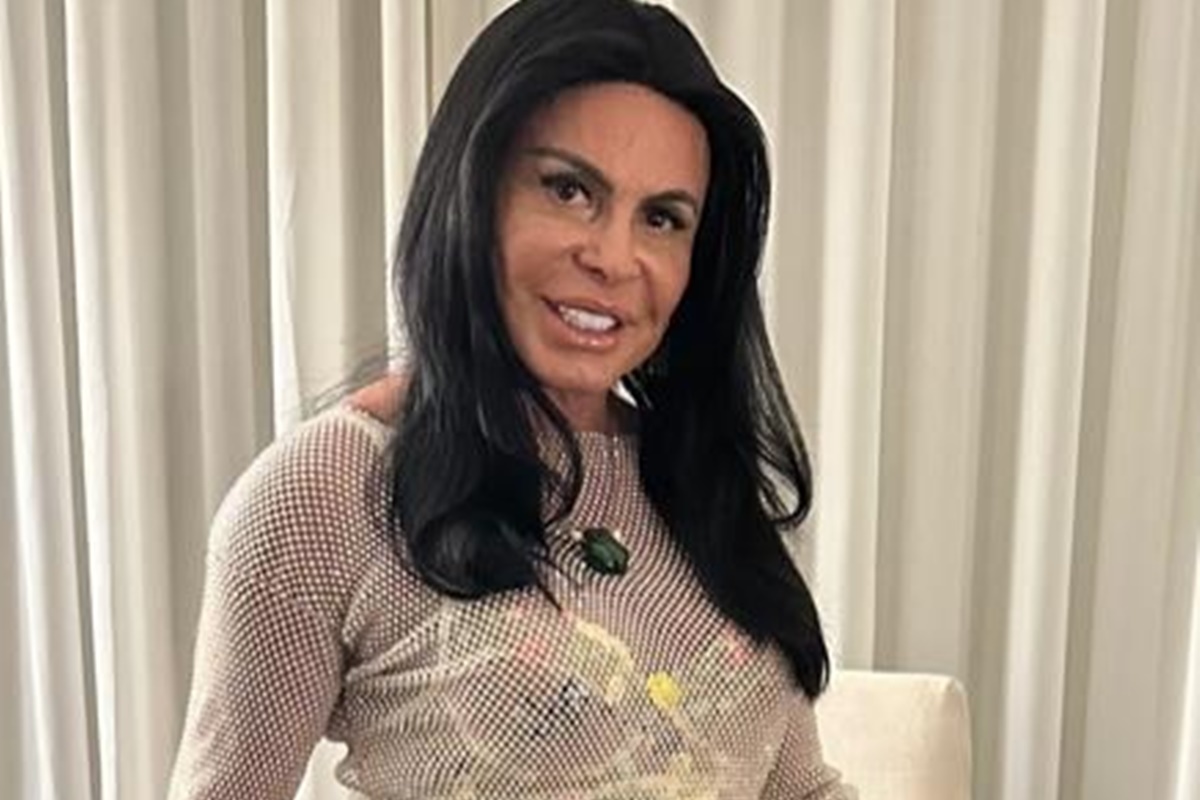 Transplante de Gretchen por alopecia: médicos explicam queda de cabelo - QTU Questões do Universo