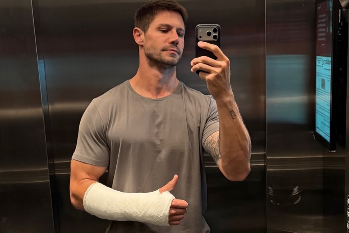 Ex-BBB Jonas Sulzbach relata dificuldades por conta de gesso no braço
