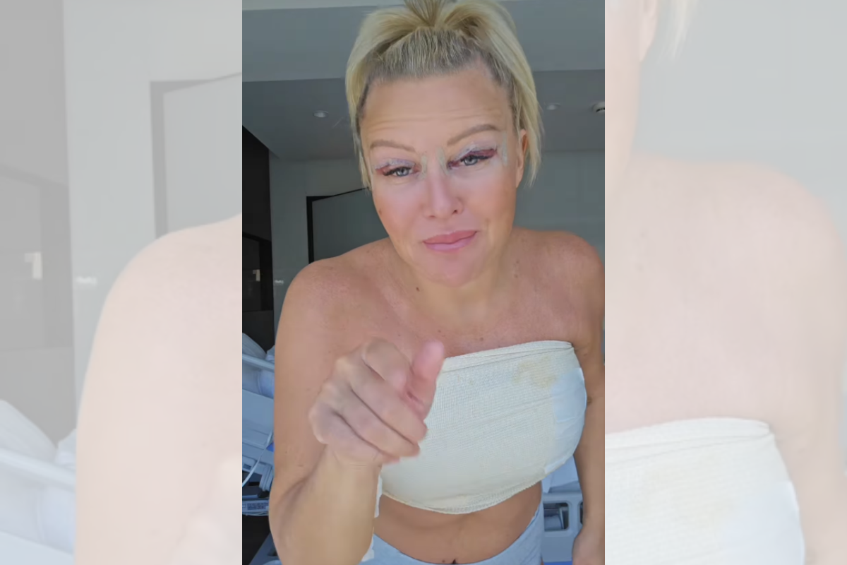Noiva de Frankenstein mulher relata cirurgias feitas até na vagina