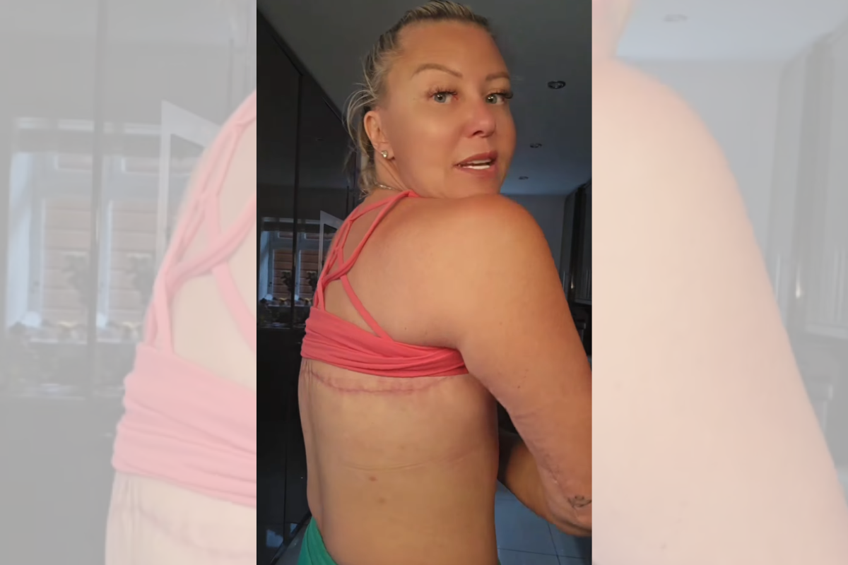 Apesar das cicatrizes, a mãe de dois filhos diz que finalmente “se ama e se sente bem consigo mesma”