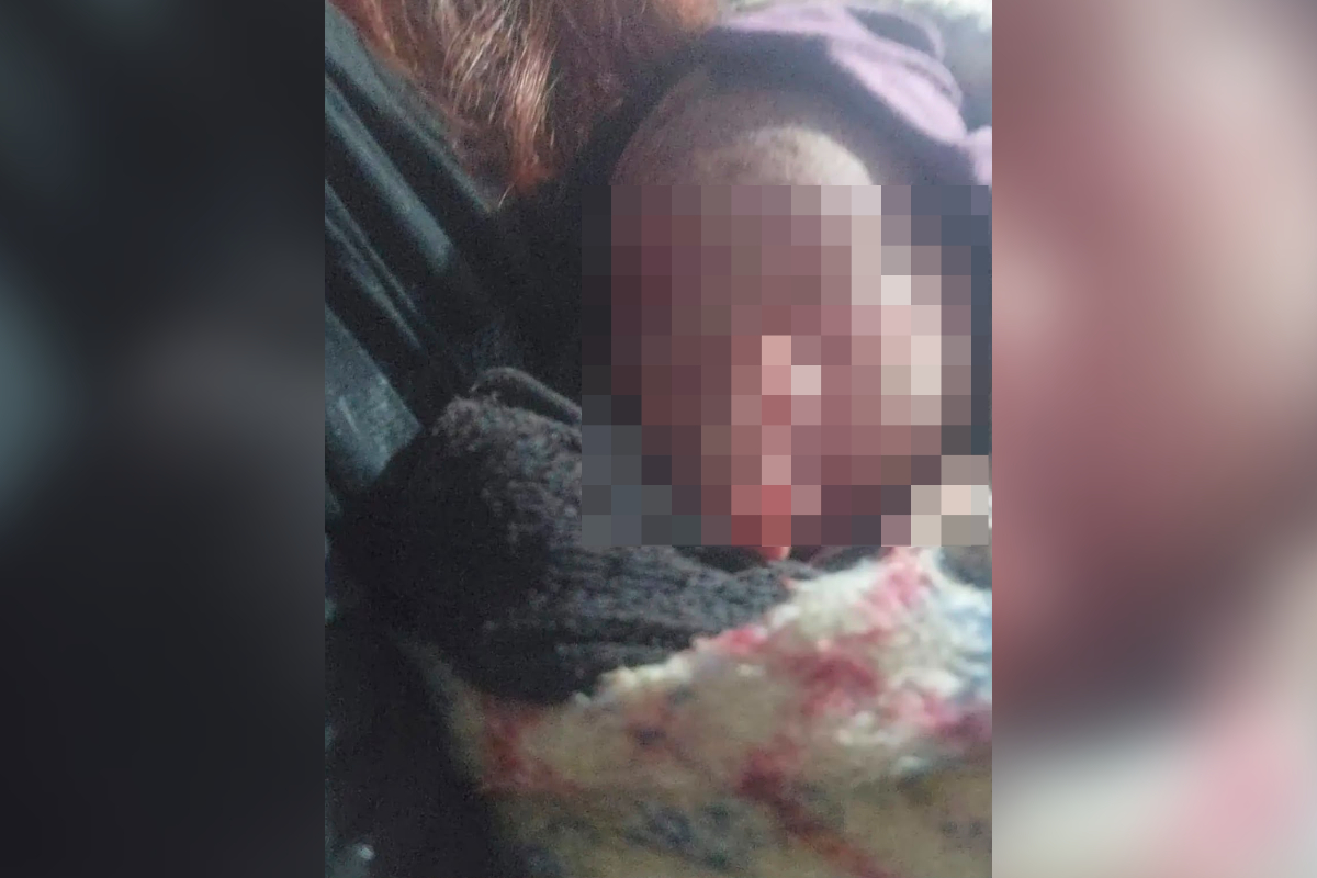 Bebê Abandonada em Lixo: Mulher Intervém em Ato Heroico