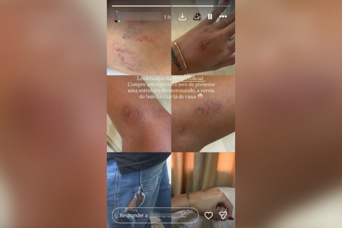 ferimentos exposete