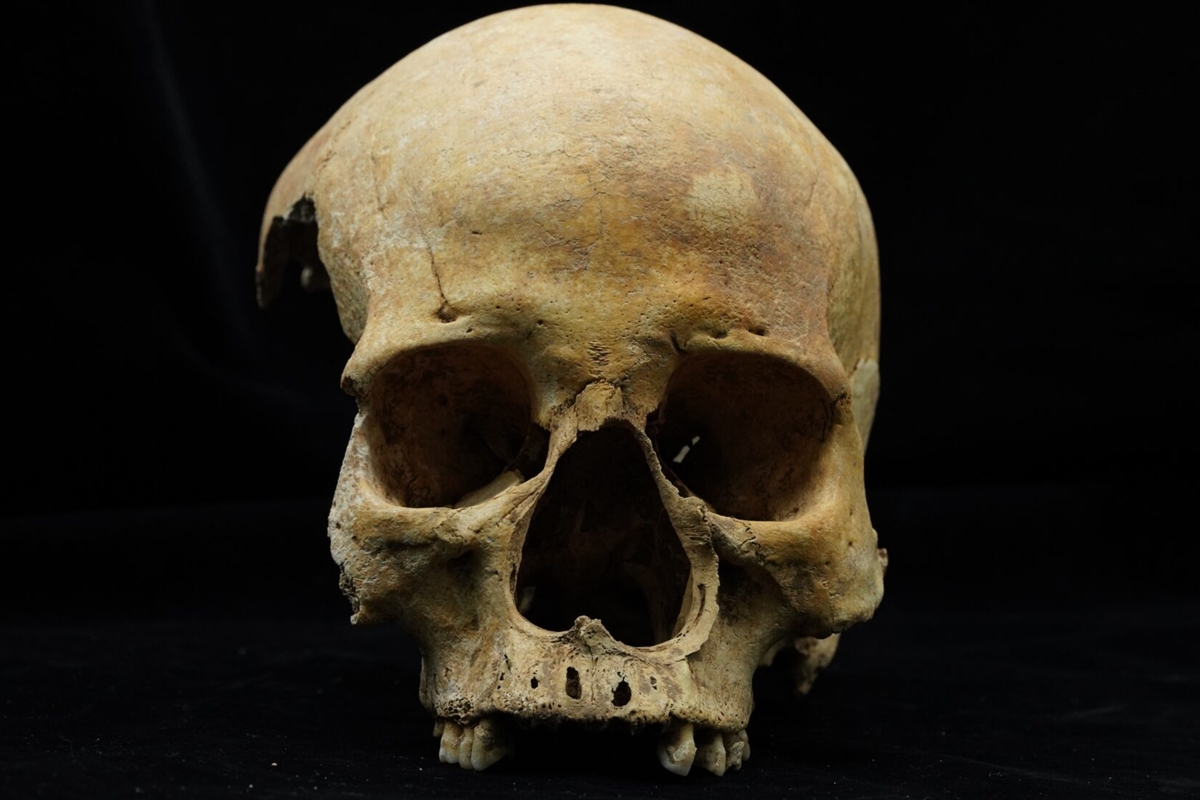 Mulher enterrada de bruços teve nariz amputado há cerca de 700 anos