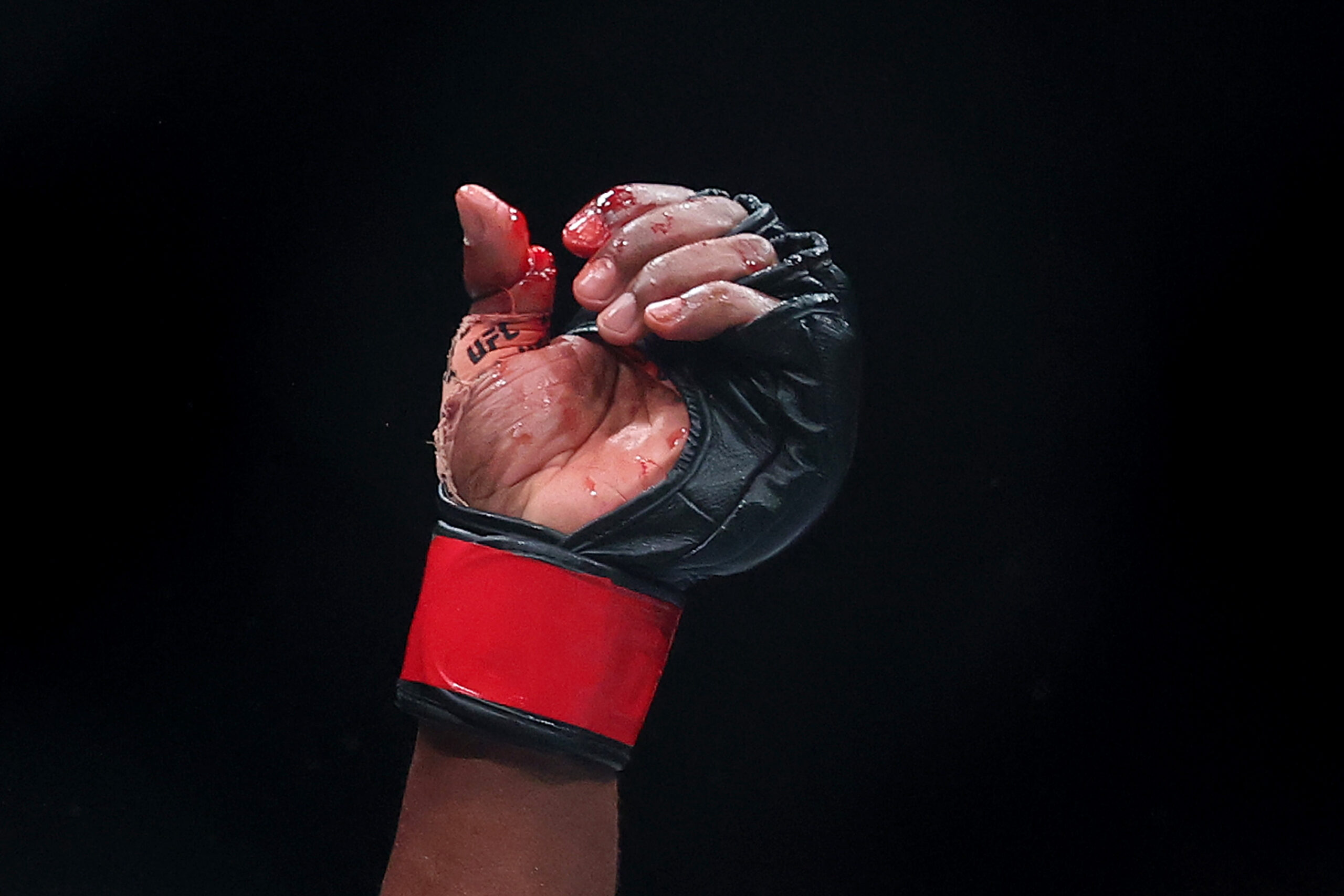 UFC: lutador recebe suspensão de seis meses por fratura exposta em duelo