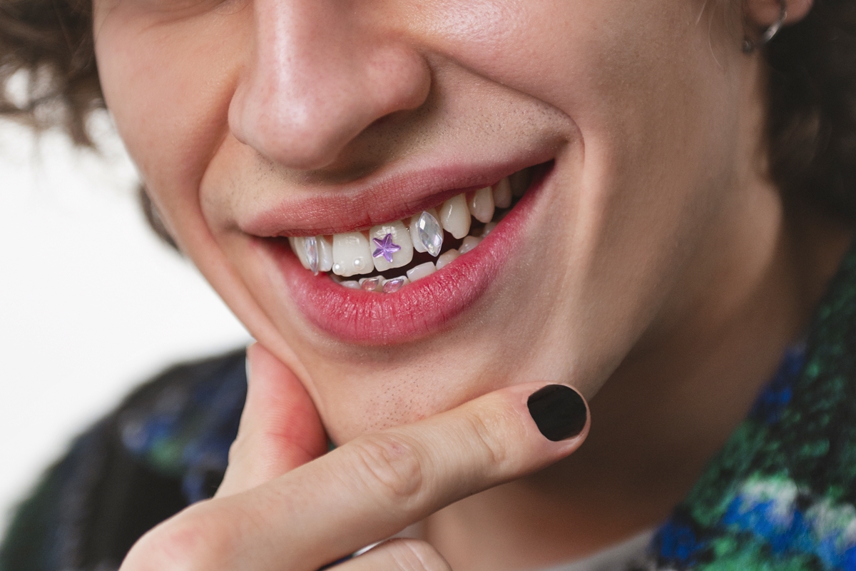 dentes com joias