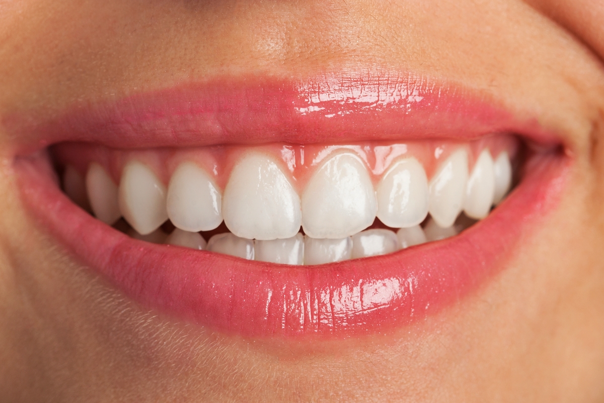 dentes