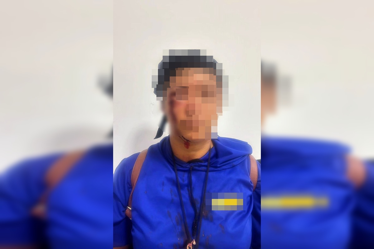 "Colocar pimenta no seu prikito", ameaçou agressora que chicoteou mulher - QTU Questões do Universo