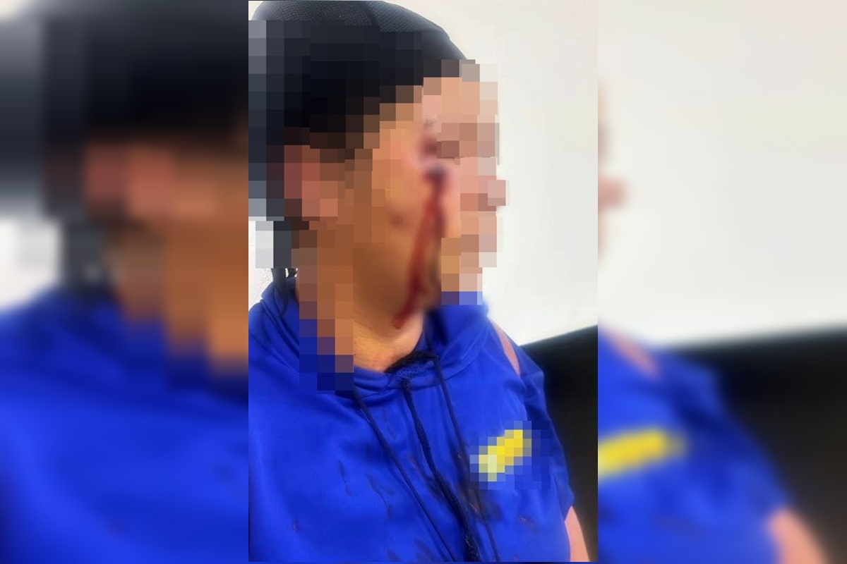Mulher é chicoteada após ser acusada de relação com homem casado no Entorno