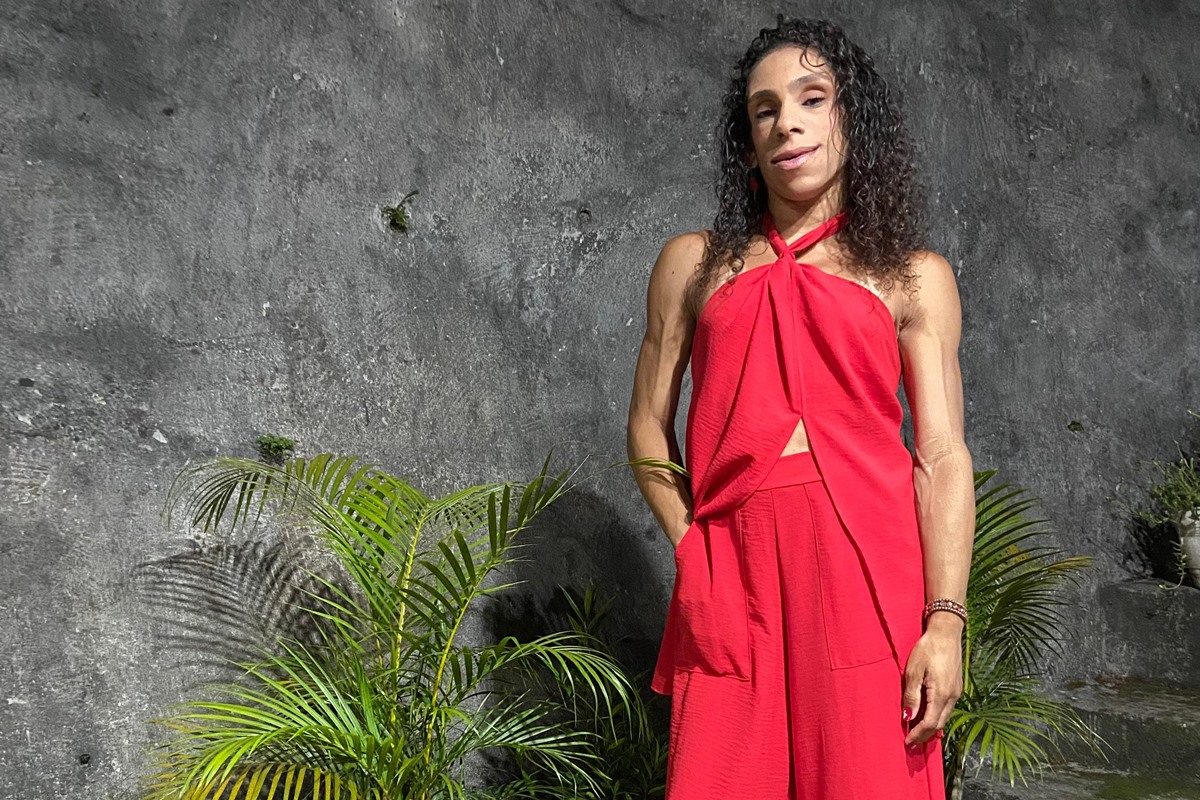 Doença rara faz mulher ter ausência quase total de gordura aparente