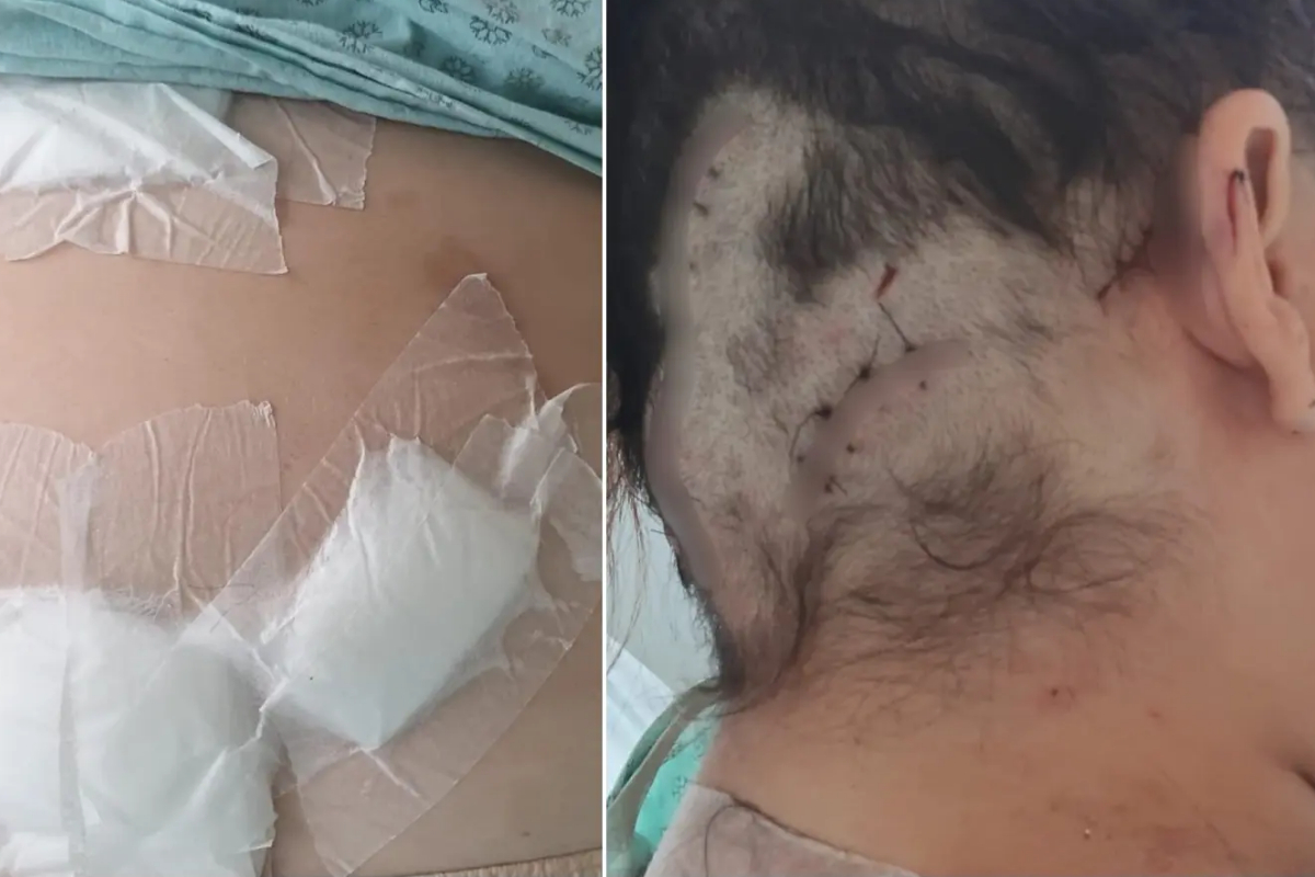 Homem é preso no Ceará após tentar matar a ex com 12 facadas - QTU Questões do Universo
