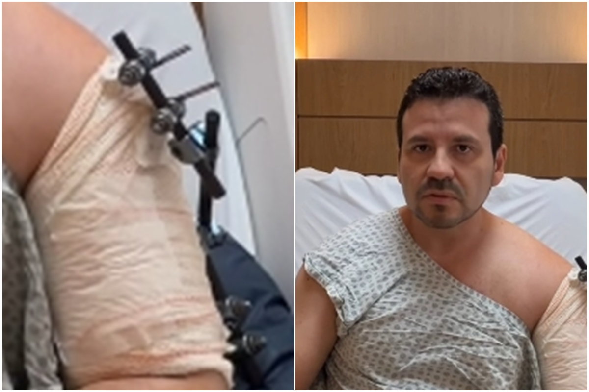 Médico em carro blindado cai em golpe do retrovisor e acaba baleado no Rio