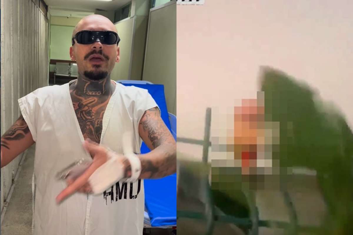 Streamer diz ter perdido dedo ao tentar invadir Rock in Rio e o leiloa - Foto