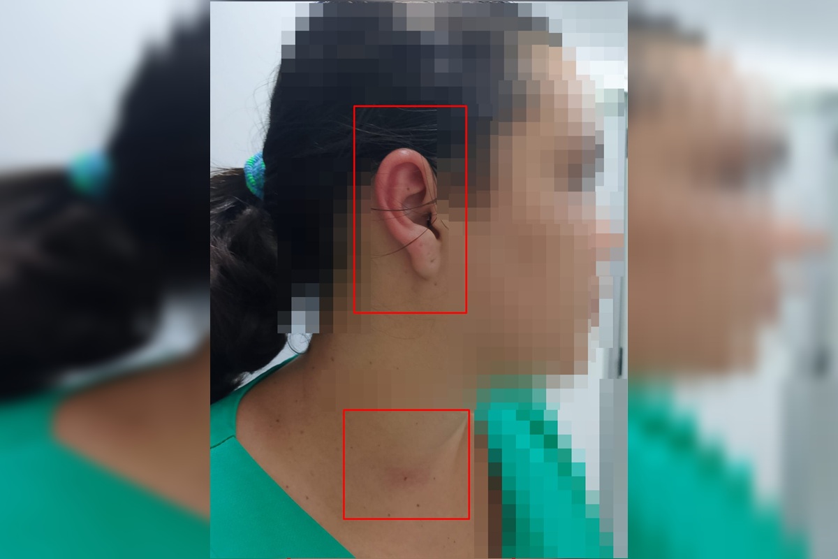 Técnica de enfermagem é agredida por paciente e acompanhante em UPA no DF