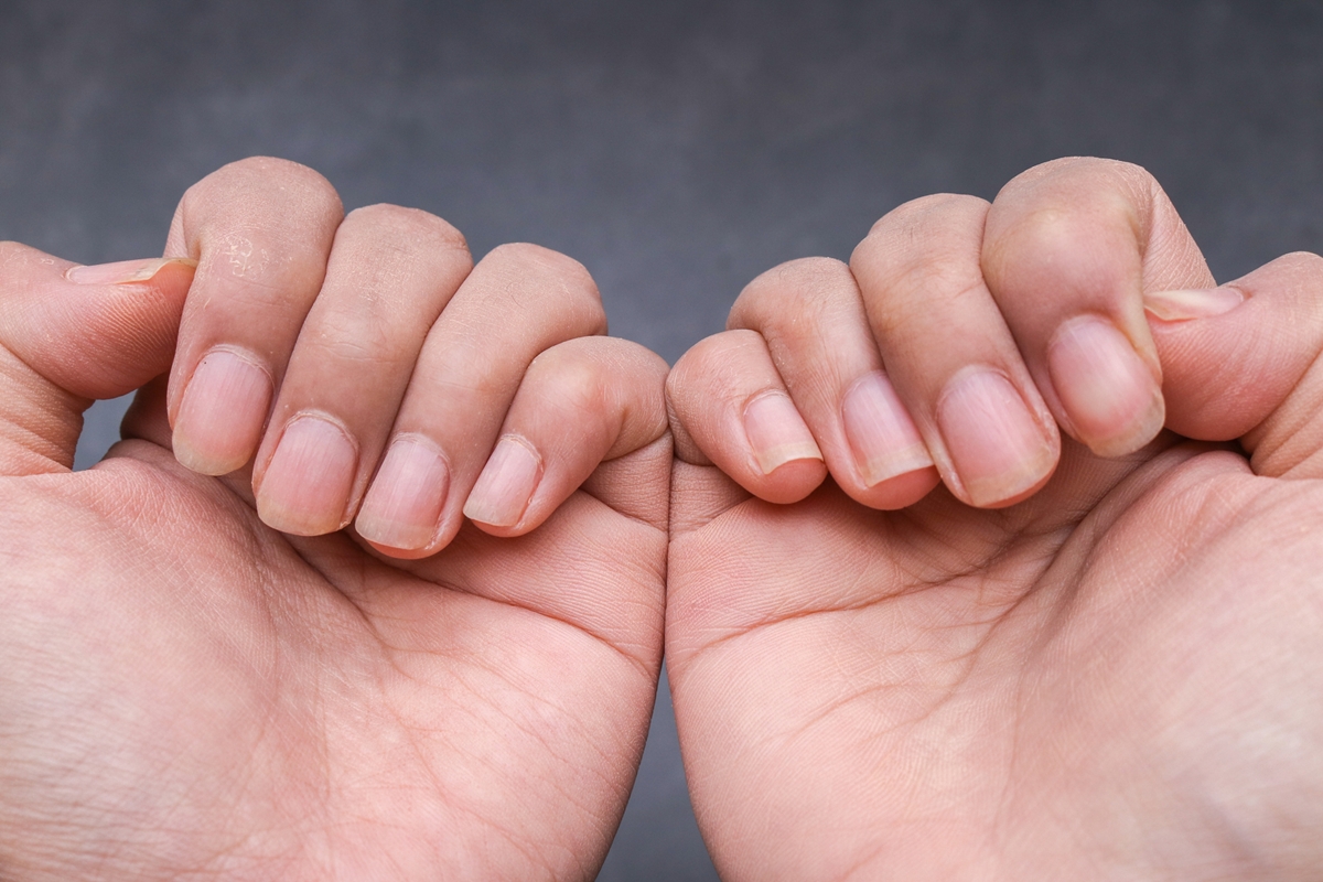 Foto colorida de mãos com unhas sem esmalte - Metrópoles