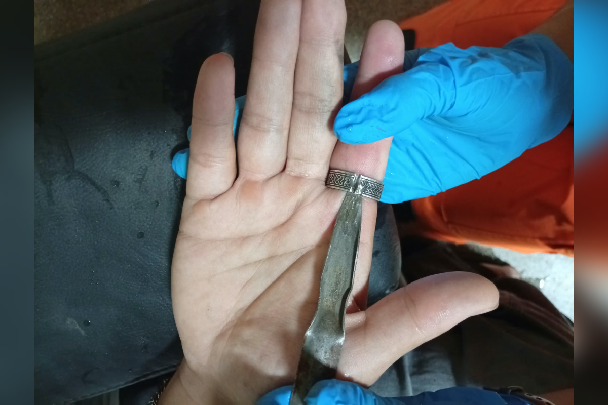Bombeiro retira anel preso no dedo de uma pessoa em Campo Belo MG