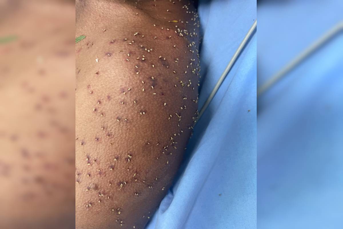 Homem é resgatado inconsciente e em estado grave após ataque de abelhas