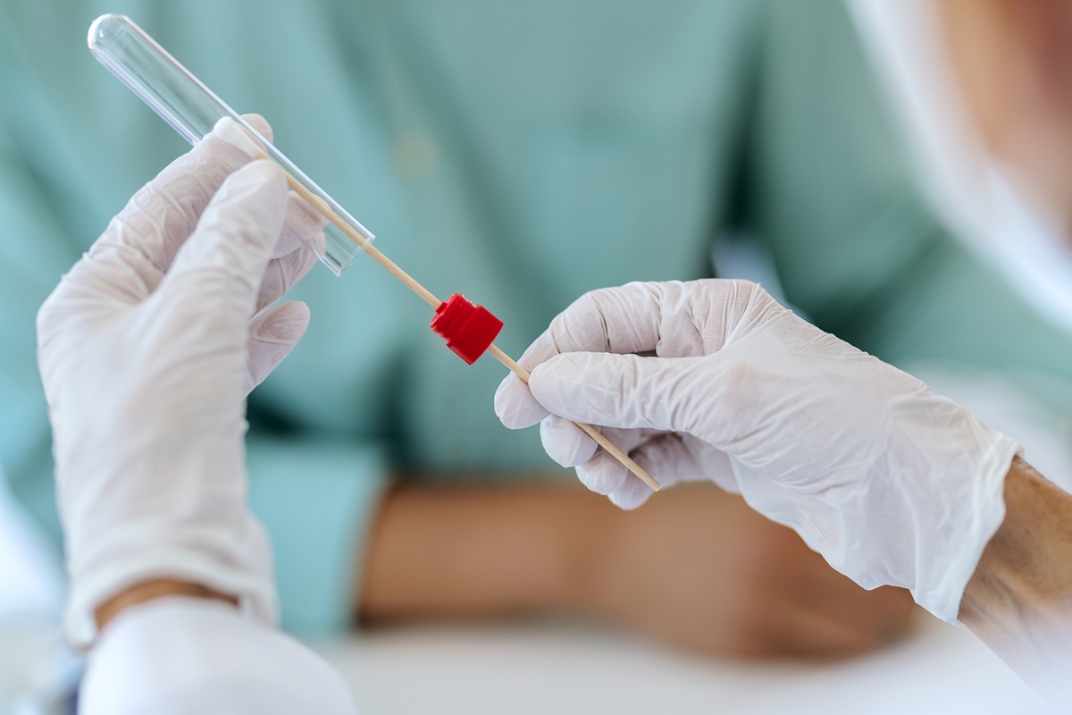 Teste com cotonete pode evitar biópsias em casos suspeitos de câncer